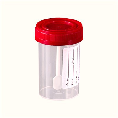 De Urinecontainer van de het ziekenhuis Steriele Kruk met Lepel 30ml 60ml 90ml 120ml