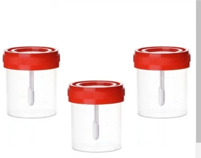 Best verkopende medische urinecontainers nauwkeurig en hygiënisch